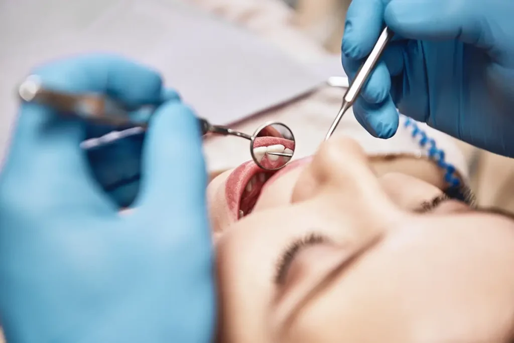 Teeth being inspected during a dentist appointment